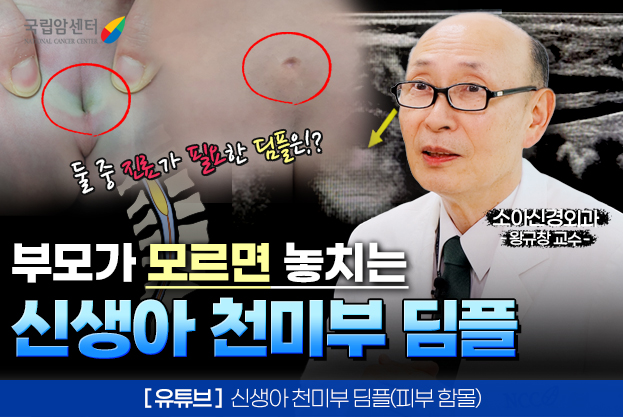 둘중 진료가 필요한 딤플은 부모가 모르면 놓치는 신생아 천미부 딤플 유튜브 신생아 천미부 딤플 피부 함몰 소아신경외과 왕규창 교수